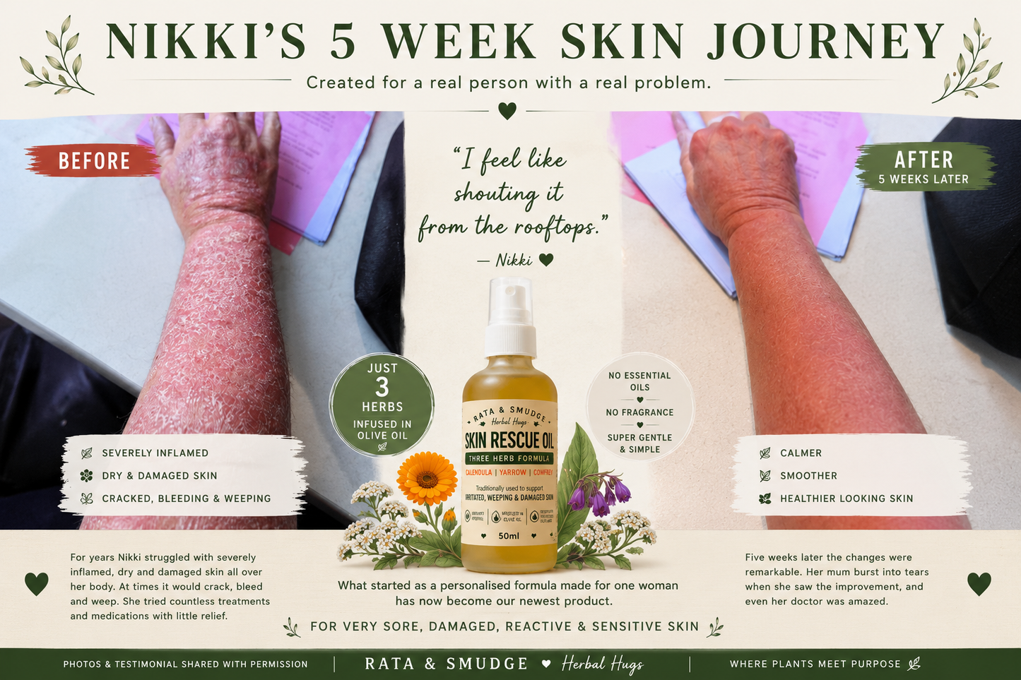 Skin Rescue Oil, Created for a real person with a real problem